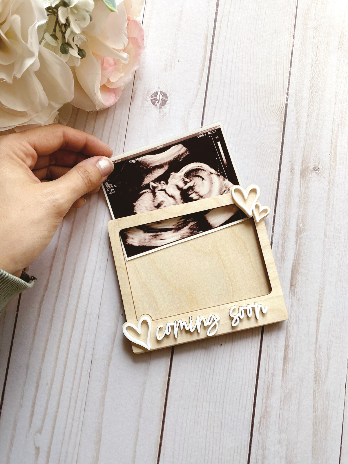 Ultrasound Photo Frame | Pregnancy Annoucement