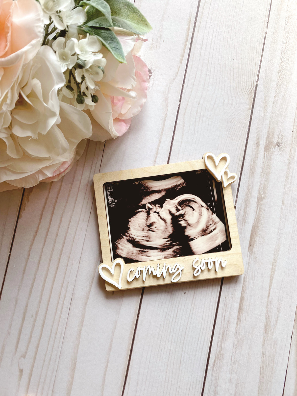 Ultrasound Photo Frame | Pregnancy Annoucement